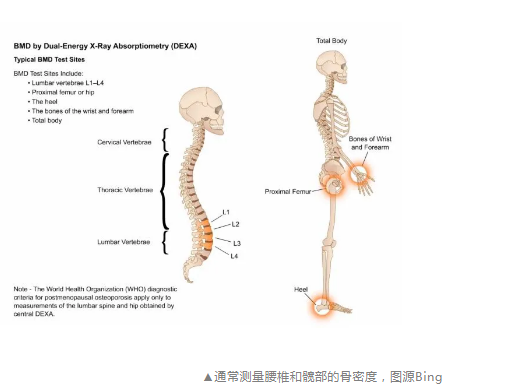 超声波【骨密度检测仪​】品牌国康介绍测骨密度的部位是哪哦？咱们来看一哈~