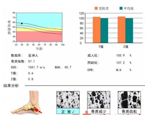 超声骨密度检测仪生产厂家提示如何提高青春期骨密度值的促进作用